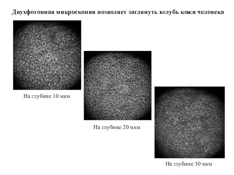 На глубине 10 мкм На глубине 20 мкм На глубине