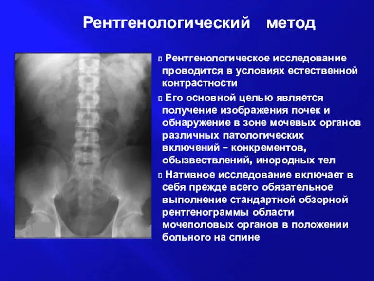 Рентгенологический метод Рентгенологическое исследование проводится в условиях естественной контрастности Его