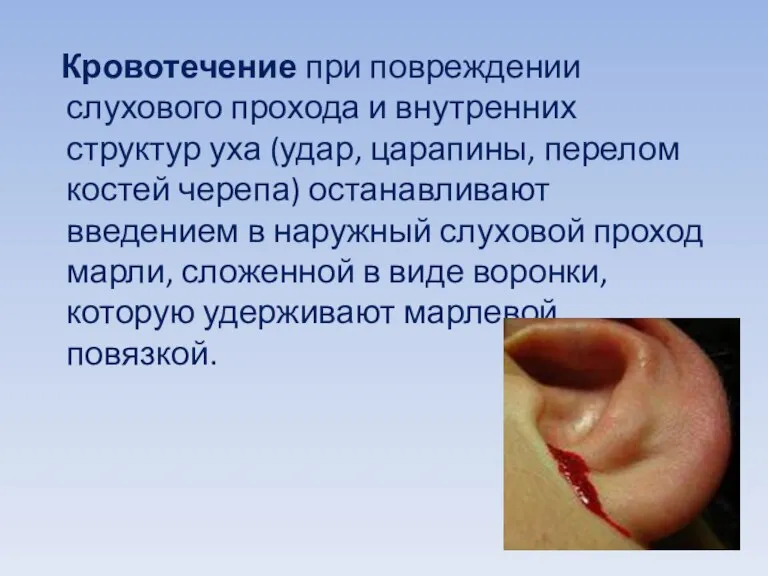 Кровотечение при повреждении слухового прохода и внутренних структур уха (удар,