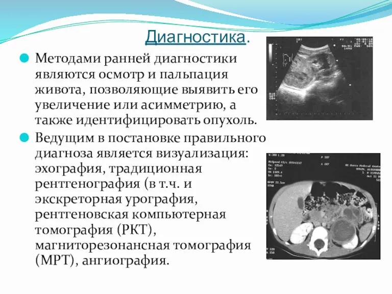 Диагностика. Методами ранней диагностики являются осмотр и пальпация живота, позволяющие