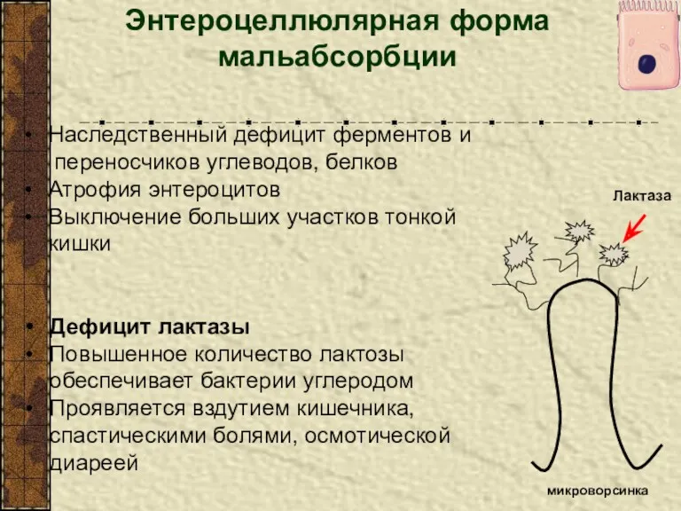 Энтероцеллюлярная форма мальабсорбции микроворсинка Лактаза Наследственный дефицит ферментов и переносчиков