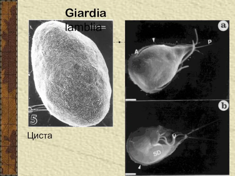 Giardia lamblia Clinical Microbiology Reviews, 13, p. 35-54 Циста