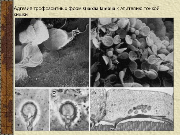 Адгезия трофозоитных форм Giardia lamblia к эпителию тонкой кишки