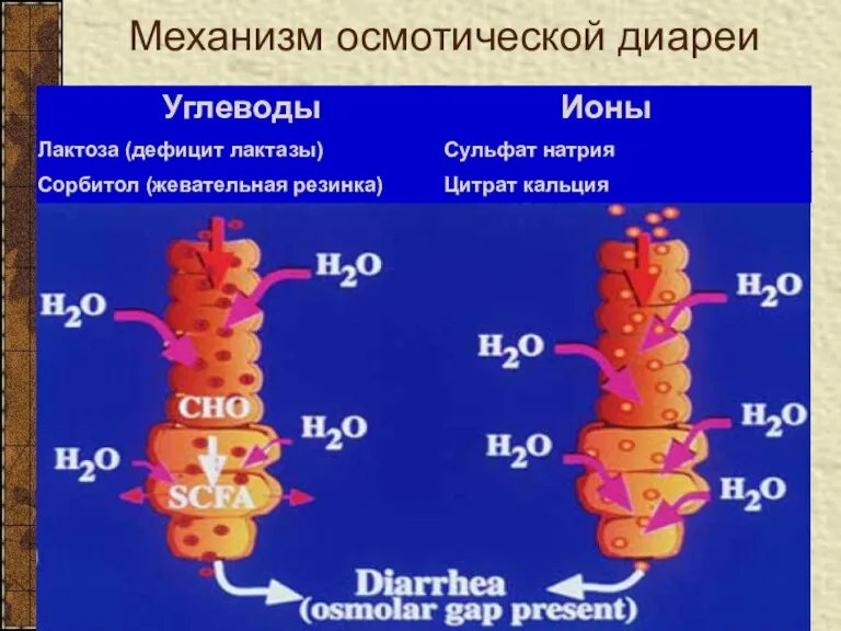 Механизм осмотической диареи Углеводы Лактоза (дефицит лактазы) Сорбитол (жевательная резинка) Ионы Сульфат натрия Цитрат кальция