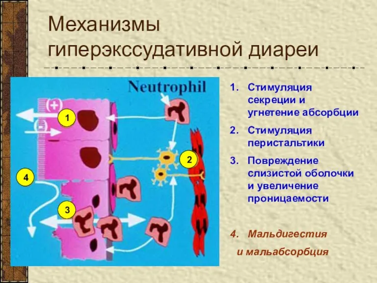 Механизмы гиперэкссудативной диареи Стимуляция секреции и угнетение абсорбции Стимуляция перистальтики