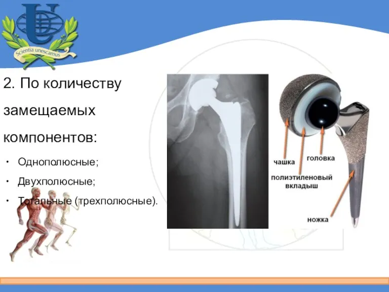 2. По количеству замещаемых компонентов: Однополюсные; Двухполюсные; Тотальные (трехполюсные).