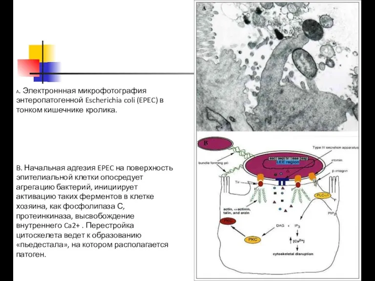 A. Электроннная микрофотография энтеропатогенной Escherichia coli (EPEC) в тонком кишечнике кролика. B. Начальная