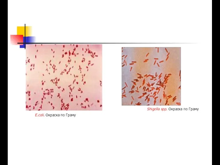 E.coli. Окраска по Граму Shigella spp. Окраска по Граму