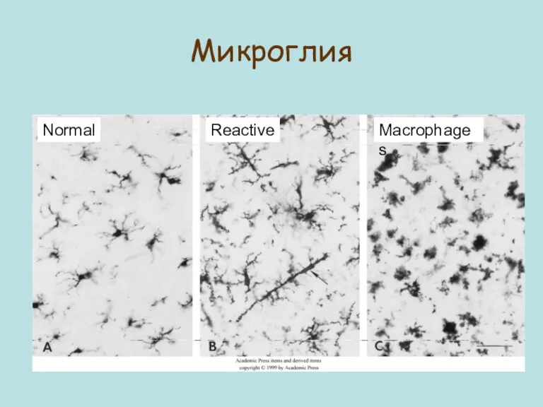 Микроглия Normal Reactive Macrophages