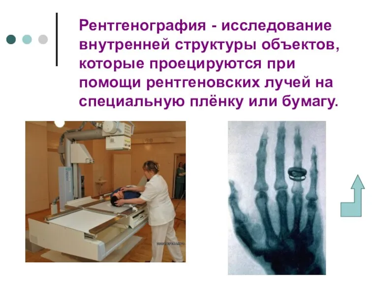 Рентгенография - исследование внутренней структуры объектов, которые проецируются при помощи