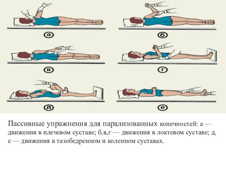 Пассивные упражнения для парализованных конечностей: а — движения в плечевом