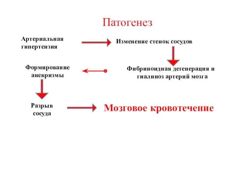 Артериальная гипертензия Изменение стенок сосудов Фибриноидная дегенерация и гиалиноз артерий