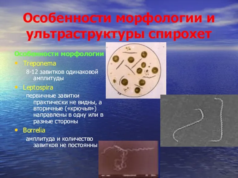 Особенности морфологии и ультраструктуры спирохет Особенности морфологии Treponema 8-12 завитков одинаковой амплитуды Leptospira