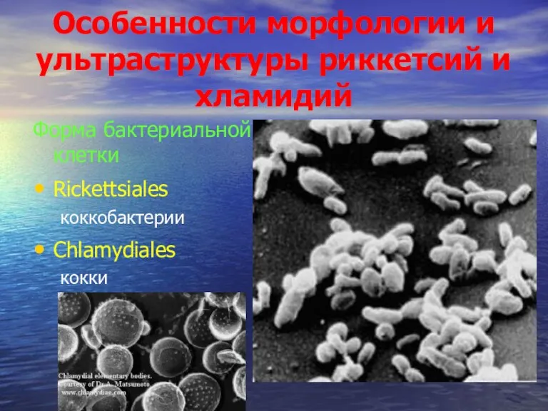 Особенности морфологии и ультраструктуры риккетсий и хламидий Форма бактериальной клетки Rickettsiales коккобактерии Chlamydiales кокки
