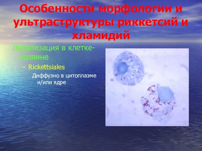 Особенности морфологии и ультраструктуры риккетсий и хламидий Локализация в клетке-хозяине Rickettsiales Диффузно в цитоплазме и/или ядре