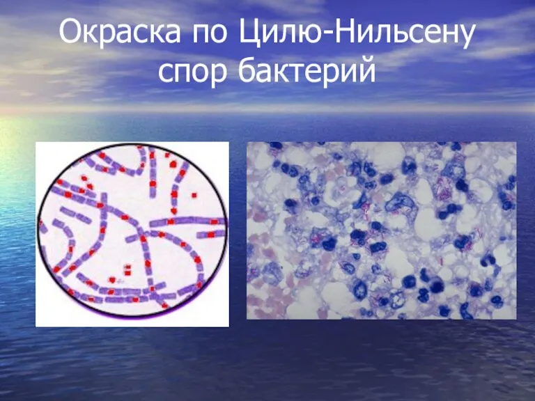 Окраска по Цилю-Нильсену спор бактерий