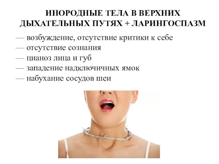 ИНОРОДНЫЕ ТЕЛА В ВЕРХНИХ ДЫХАТЕЛЬНЫХ ПУТЯХ + ЛАРИНГОСПАЗМ — возбуждение,