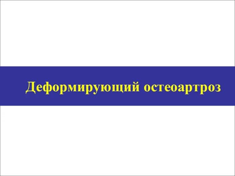 Деформирующий остеоартроз