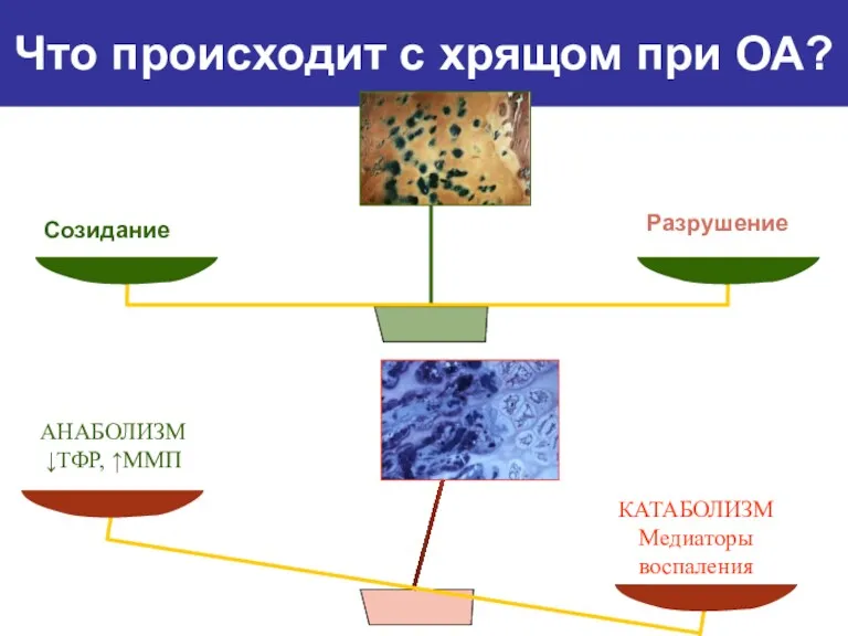 Созидание Разрушение Что происходит с хрящом при ОА? АНАБОЛИЗМ ↓ТФР, ↑ММП КАТАБОЛИЗМ Медиаторы воспаления