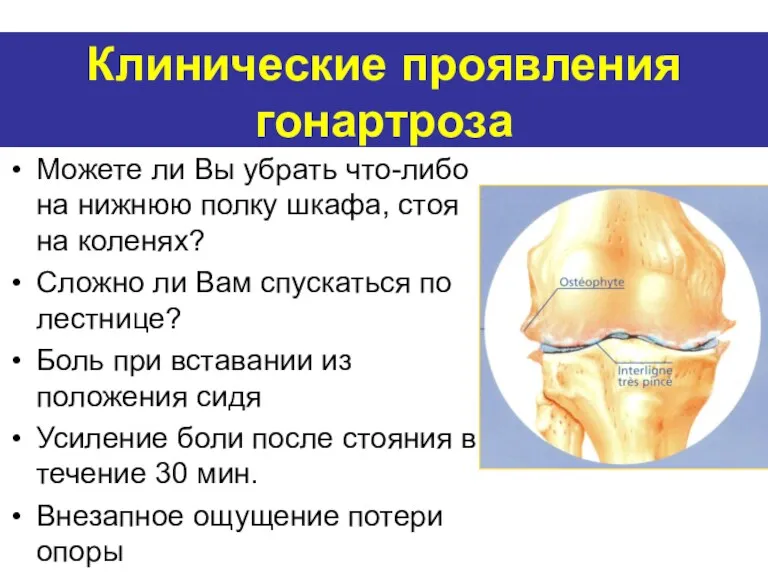 Клинические проявления гонартроза Можете ли Вы убрать что-либо на нижнюю полку шкафа, стоя