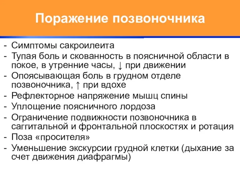 Поражение позвоночника Симптомы сакроилеита Тупая боль и скованность в поясничной