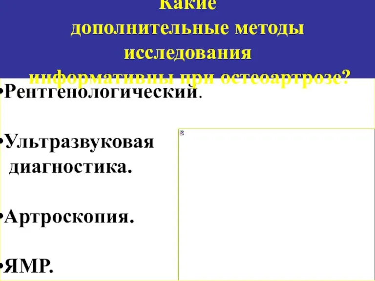 Рентгенологический. Ультразвуковая диагностика. Артроскопия. ЯМР. Какие дополнительные методы исследования информативны при остеоартрозе?