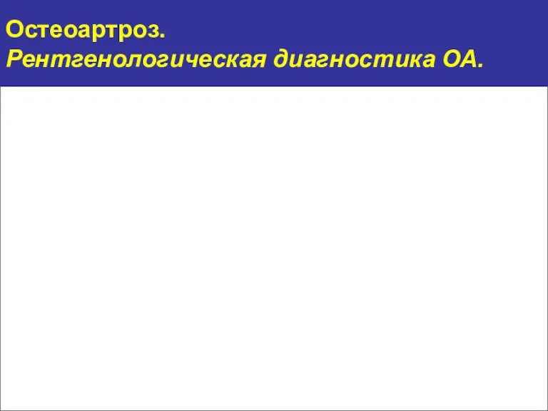 Остеоартроз. Рентгенологическая диагностика ОА.