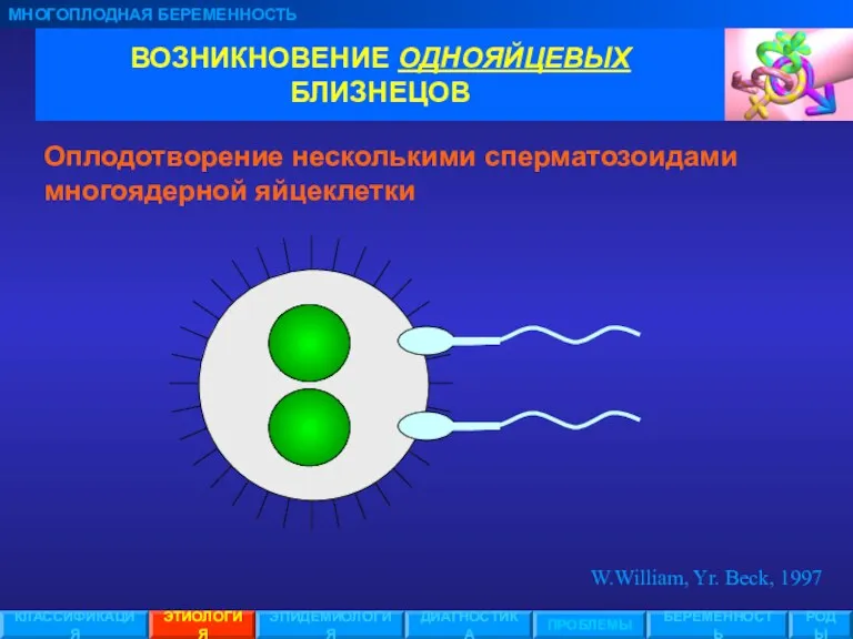 ВОЗНИКНОВЕНИЕ ОДНОЯЙЦЕВЫХ БЛИЗНЕЦОВ МНОГОПЛОДНАЯ БЕРЕМЕННОСТЬ ЭТИОЛОГИЯ ЭПИДЕМИОЛОГИЯ ПРОБЛЕМЫ БЕРЕМЕННОСТЬ РОДЫ