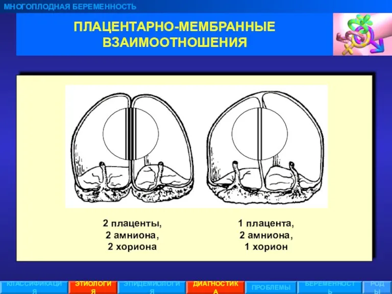 ПЛАЦЕНТАРНО-МЕМБРАННЫЕ ВЗАИМООТНОШЕНИЯ МНОГОПЛОДНАЯ БЕРЕМЕННОСТЬ ЭТИОЛОГИЯ ЭПИДЕМИОЛОГИЯ ПРОБЛЕМЫ БЕРЕМЕННОСТЬ РОДЫ КЛАССИФИКАЦИЯ