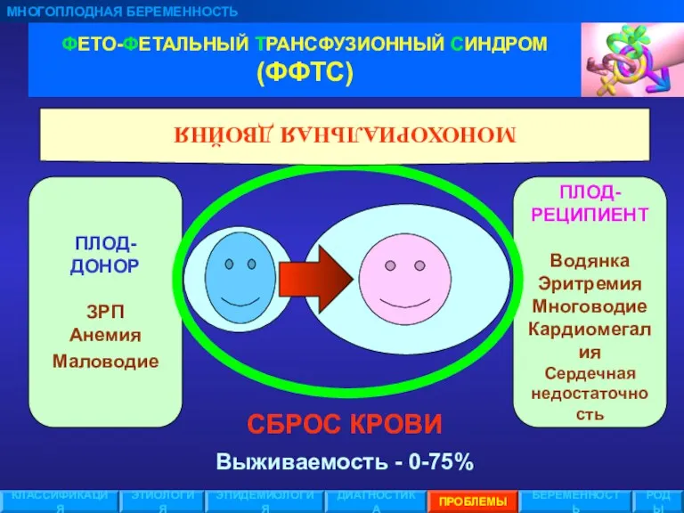 ПЛОД- РЕЦИПИЕНТ Водянка Эритремия Многоводие Кардиомегалия Сердечная недостаточность ПЛОД-ДОНОР ЗРП