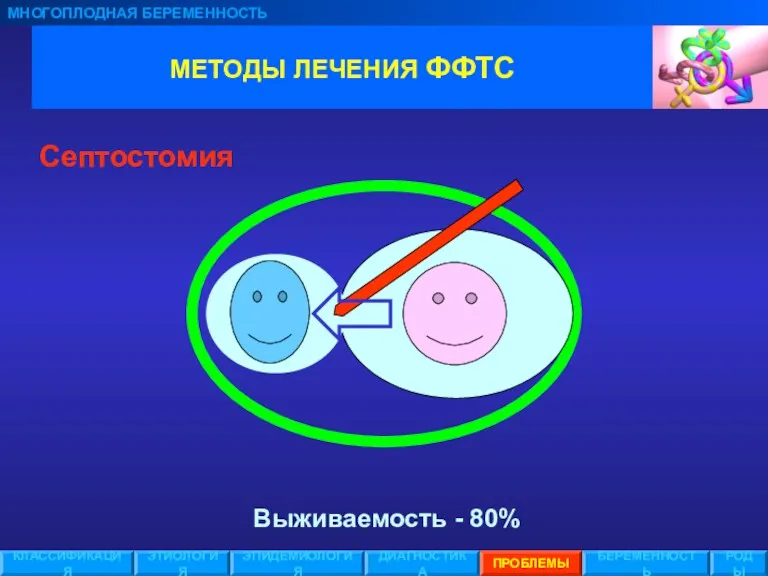 МЕТОДЫ ЛЕЧЕНИЯ ФФТС МНОГОПЛОДНАЯ БЕРЕМЕННОСТЬ ЭТИОЛОГИЯ ЭПИДЕМИОЛОГИЯ ПРОБЛЕМЫ БЕРЕМЕННОСТЬ РОДЫ КЛАССИФИКАЦИЯ ДИАГНОСТИКА Септостомия Выживаемость - 80%