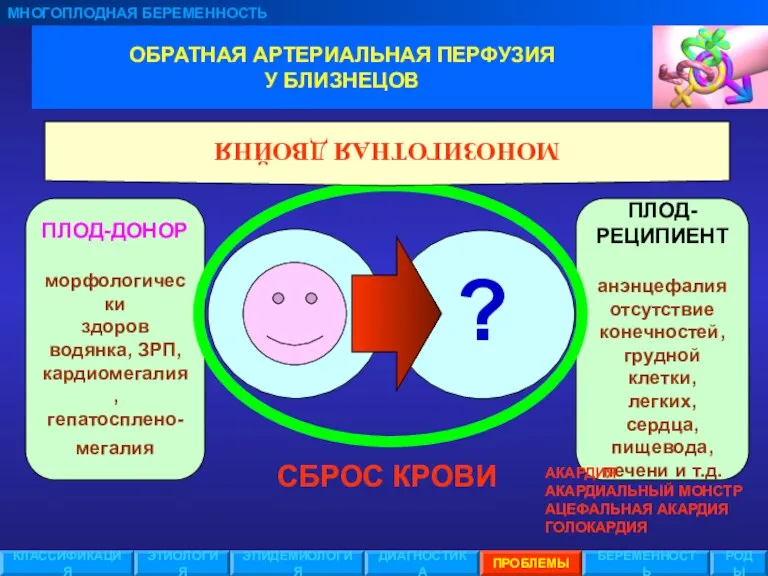 ПЛОД- РЕЦИПИЕНТ анэнцефалия отсутствие конечностей, грудной клетки, легких, сердца, пищевода,