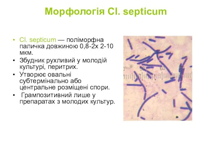 Морфологія Cl. septicum Cl. septicum — поліморфна паличка довжиною 0,8-2х