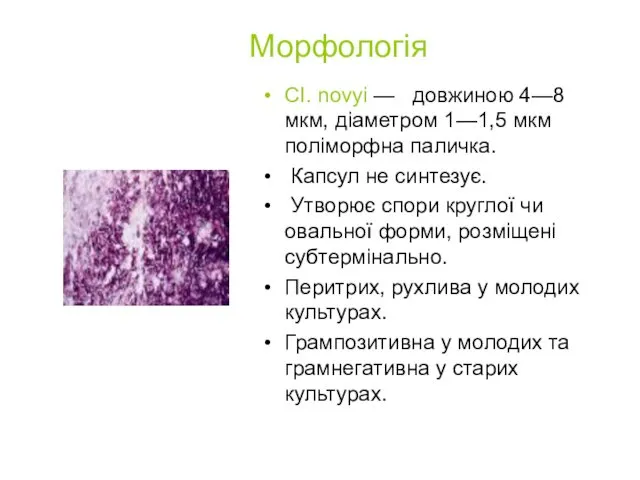 Морфологія СІ. novyi — довжиною 4—8 мкм, діаметром 1—1,5 мкм
