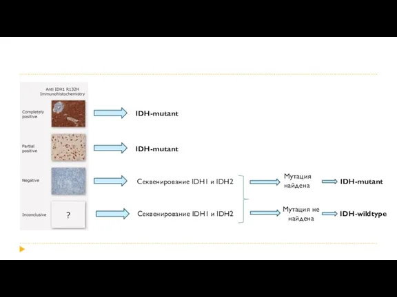 IDH-mutant IDH-mutant Секвенирование IDH1 и IDH2 Секвенирование IDH1 и IDH2