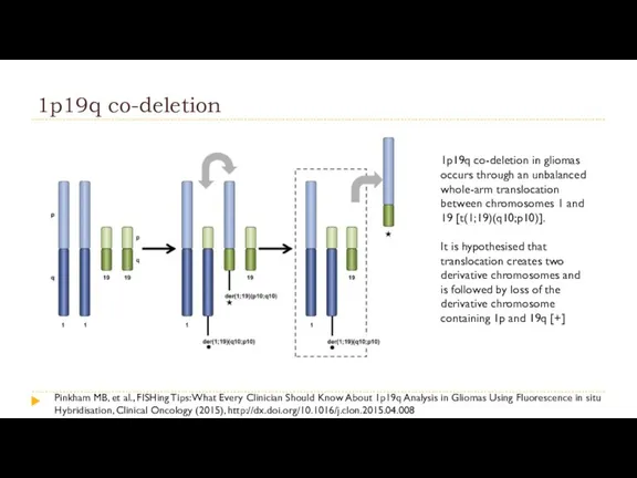 1p19q co-deletion 1p19q co-deletion in gliomas occurs through an unbalanced