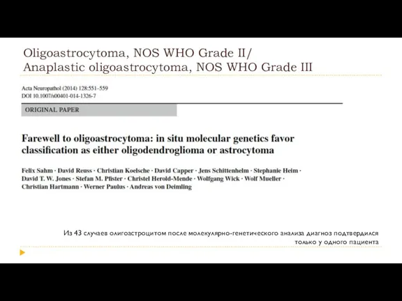Oligoastrocytoma, NOS WHO Grade II/ Anaplastic oligoastrocytoma, NOS WHO Grade