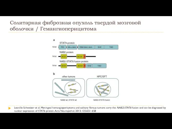 Солитарная фиброзная опухоль твердой мозговой оболочки / Гемангиоперицитома Leonille Schweizer