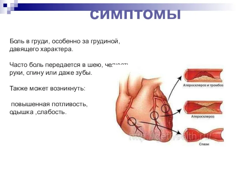 Боль в груди, особенно за грудиной, давящего характера. Часто боль передается в шею,