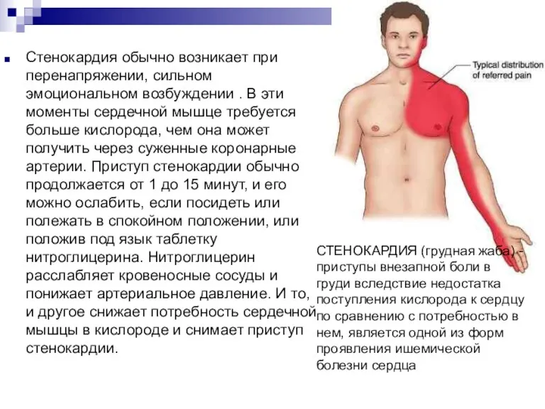 Стенокардия обычно возникает при перенапряжении, сильном эмоциональном возбуждении . В