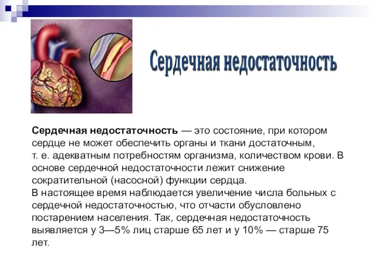 Сердечная недостаточность — это состояние, при котором сердце не может обеспечить органы и