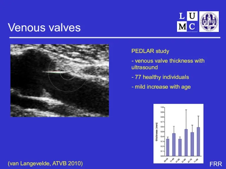 Venous valves PEDLAR study - venous valve thickness with ultrasound