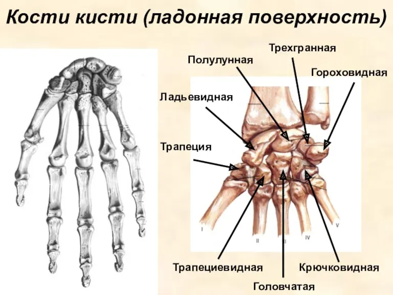 Кости кисти (ладонная поверхность) Ладьевидная Полулунная Трехгранная Гороховидная Трапеция Трапециевидная Головчатая Крючковидная