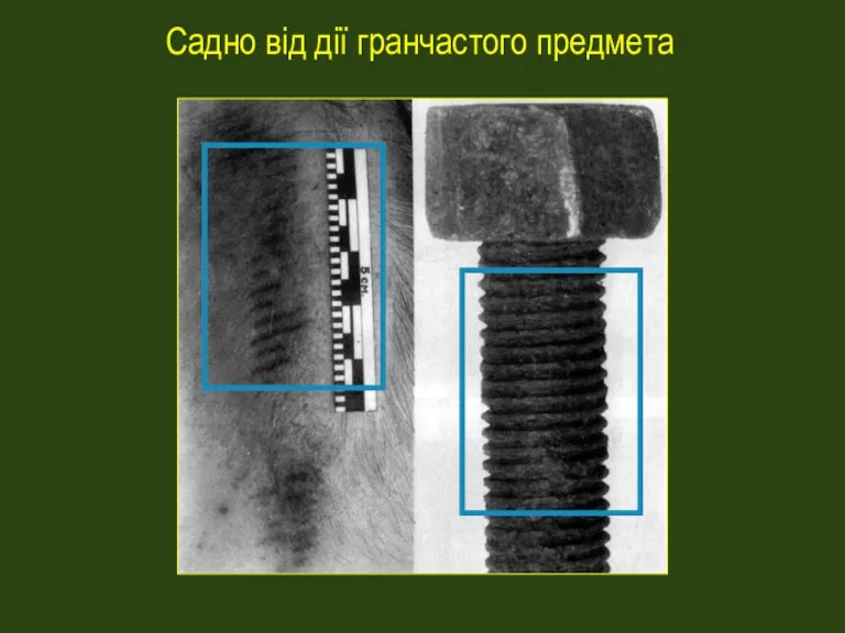 Садно від дії гранчастого предмета