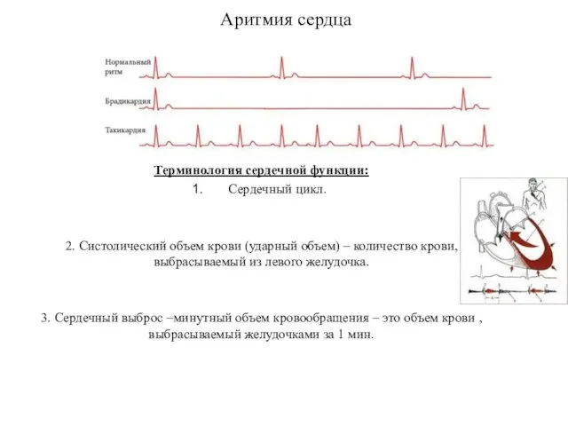 Аритмия сердца Терминология сердечной функции: Сердечный цикл. 2. Систолический объем