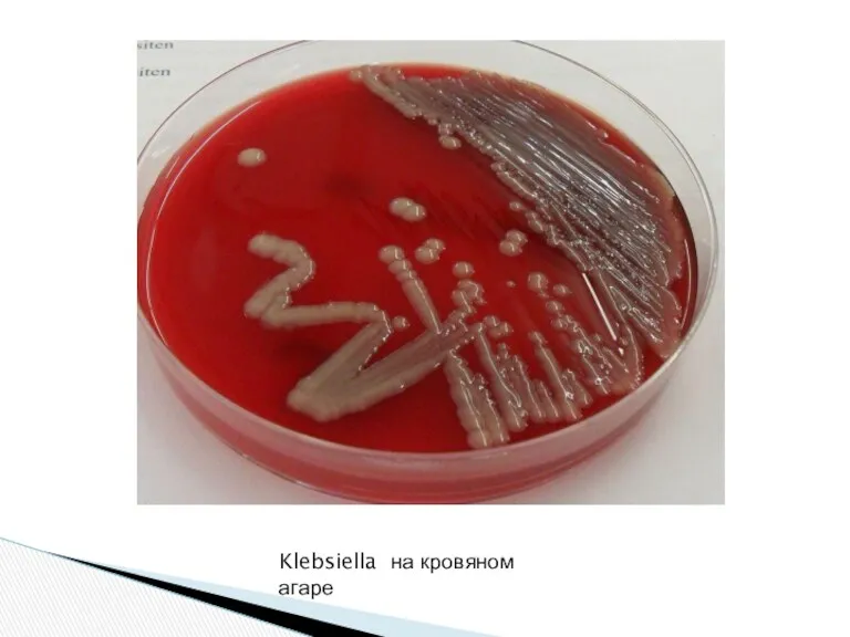 Klebsiella на кровяном агаре