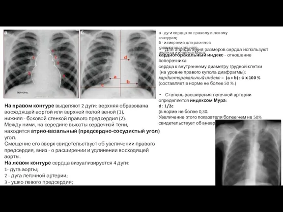 а - дуги сердца по правому и левому контурам; б - измерения для