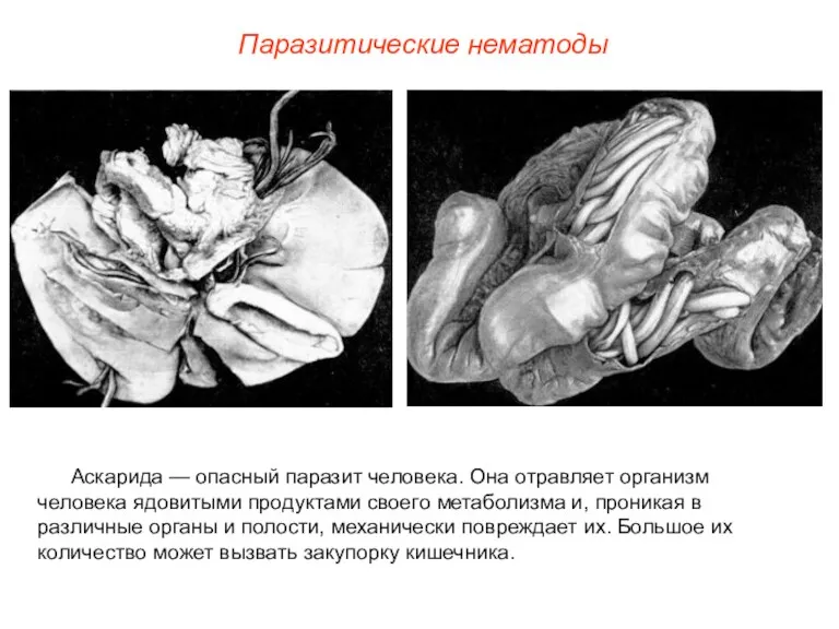 Аскарида — опасный паразит человека. Она отравляет организм человека ядовитыми