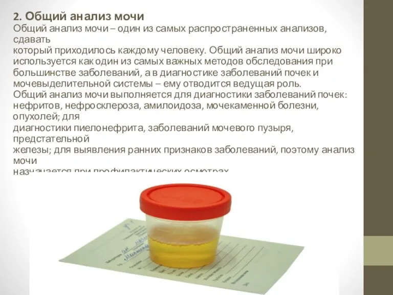 2. Общий анализ мочи Общий анализ мочи – один из