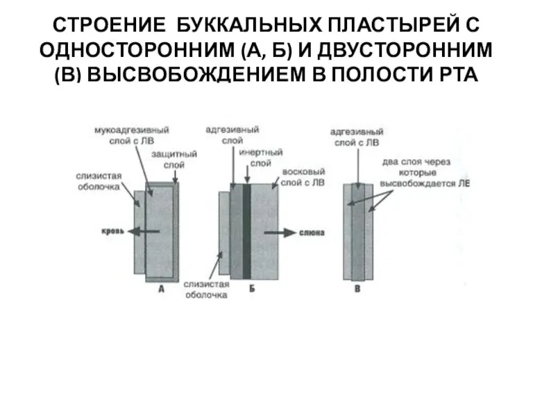 СТРОЕНИЕ БУККАЛЬНЫХ ПЛАСТЫРЕЙ С ОДНОСТОРОННИМ (А, Б) И ДВУСТОРОННИМ (В) ВЫСВОБОЖДЕНИЕМ В ПОЛОСТИ РТА